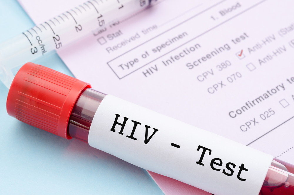 Či ste sa nakazili HIV zistíte podľa testu z krvi